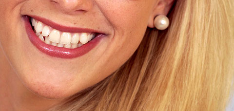 Eine lächelnde Frau schaut in die Kamera, zu sehen ist die Mundpartie mit weißen Zähnen